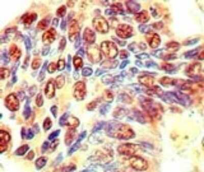 Immunohistochemistry-Paraffin EIF3J Antibody