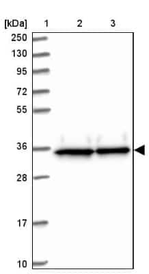 Western Blot: EIF3J Antibody [NBP2-13953] - Lane 1: Marker  [kDa] 250, 130, 95, 72, 55, 36, 28, 17, 10.  Lane 2: Human cell line RT-4.  Lane 3: Human cell line U-251MG sp