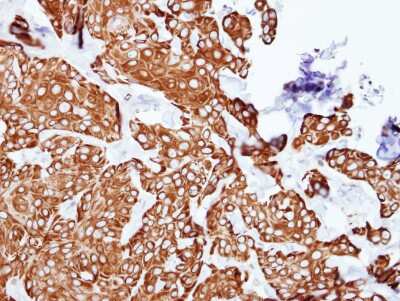 Immunohistochemistry-Paraffin: EIF3M Antibody [NBP1-31045] - Cal27 xenograft, using PCID1 antibody at 1:500 dilution.  Antigen Retrieval: Trilogy™ (EDTA based, pH 8.0) buffer, 15min
