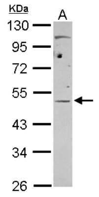 Western Blot: EIF4A3 Antibody [NBP2-16305] - Sample (30 ug of whole cell lysate) A: Raji 10% SDS PAGE gel, diluted at 1:1000.