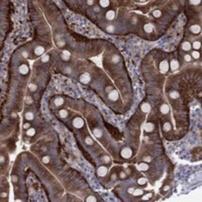 Immunohistochemistry-Paraffin: EIF4E3 Antibody [NBP3-17244] - Staining of human duodenum shows strong cytoplasmic positivity in glandular cells.