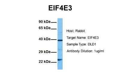 Western Blot: EIF4E3 Antibody [NBP2-82987] - Host: Rabbit. Target Name: EIF4E3. Sample Tissue: Human DLD1. Antibody Dilution: 1.0ug/ml