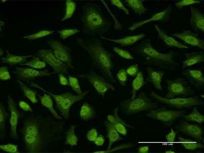 Immunocytochemistry/Immunofluorescence: EIF4EBP3 Antibody (1E3) [H00008637-M11] - Analysis of monoclonal antibody to EIF4EBP3 on HeLa cell. Antibody concentration 10 ug/ml