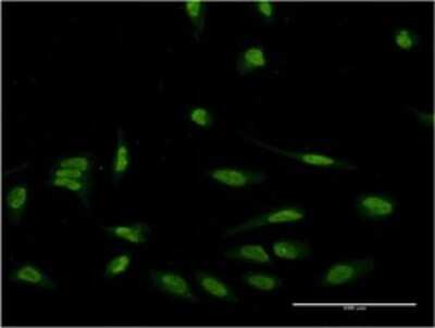 Immunocytochemistry/Immunofluorescence: EIF4EBP3 Antibody (4C1) [H00008637-M05] - Analysis of monoclonal antibody to EIF4EBP3 on HeLa cell. Antibody concentration 10 ug/ml