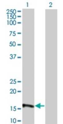 Western Blot: EIF4EBP3 Antibody (4C1) [H00008637-M05] - Analysis of EIF4EBP3 expression in transfected 293T cell line by EIF4EBP3 monoclonal antibody (M05), clone 4C1. Lane 1: EIF4EBP3 transfected lysatE (10.873 KDa). Lane 2: Non-transfected lysate.