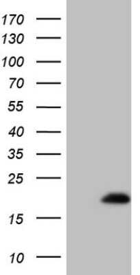 Western Blot: EIF4EBP3 Antibody (OTI3B9) - Azide and BSA Free [NBP2-71383] - Analysis of HEK293T cells were transfected with the pCMV6-ENTRY control (Left lane) or pCMV6-ENTRY EIF4EBP3.