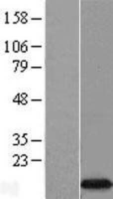 Western Blot EIF4EBP3 Overexpression Lysate