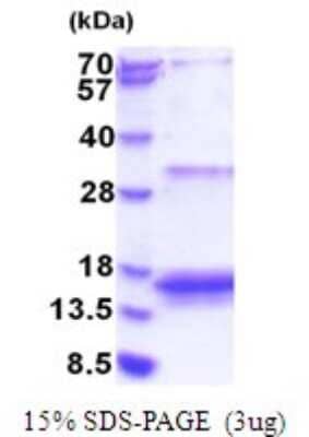SDS-PAGE Recombinant Human EIF4EBP3 His Protein