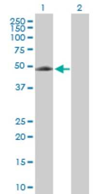 Western Blot: EIF5 Antibody [H00001983-D01P] - Analysis of EIF5 expression in transfected 293T cell line by EIF5 rabbit polyclonal antibody.Lane 1: EIF5 transfected lysate(49.20 KDa).Lane 2: Non-transfected lysate.