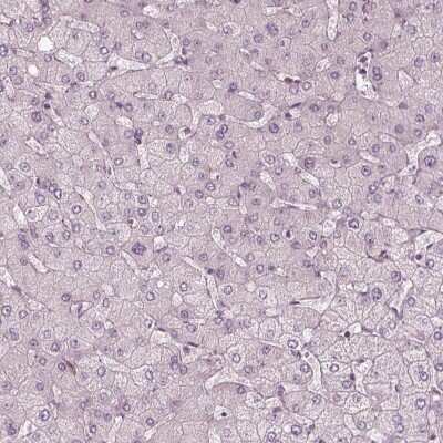 Immunohistochemistry-Paraffin: EIG121 Antibody [NBP2-57699] - Staining of human liver shows low expression as expected.