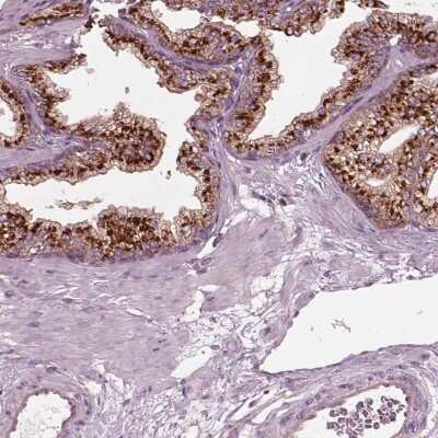 Immunohistochemistry-Paraffin: EIG121 Antibody [NBP2-57699] - Staining of human prostate shows high expression.