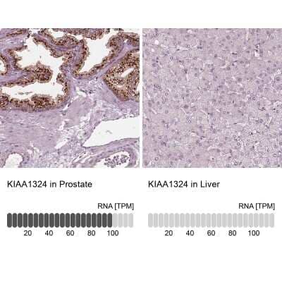 Immunohistochemistry-Paraffin: EIG121 Antibody [NBP2-57699] - Staining in human prostate and liver tissues using anti-KIAA1324 antibody. Corresponding KIAA1324 RNA-seq data are presented for the same tissues.