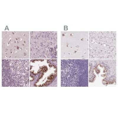 <b>Independent Antibodies Validation and Orthogonal Strategies Validation.</b>Immunohistochemistry-Paraffin: EIG121 Antibody [NBP2-57699] - Staining of human cerebral cortex, liver, lymph node and prostate using Anti-KIAA1324 antibody NBP2-57699 (A) shows similar protein distribution across tissues to independent antibody NBP1-90479 (B).