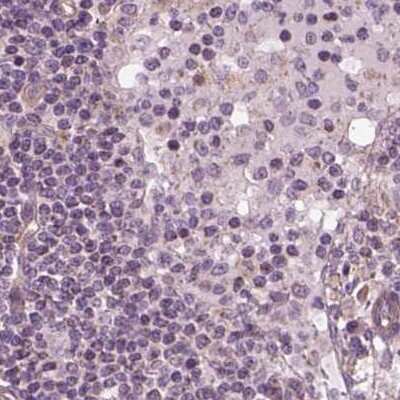 Immunohistochemistry-Paraffin: EIG121 Antibody [NBP2-57699] - Staining of human lymph node.