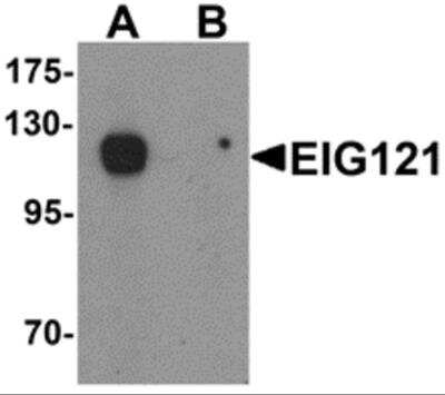 Western Blot: EIG121 Antibody [NBP2-81949] - Analysis of EIG121 in MCF7 cell lysate with EIG121 antibody at 1 ug/ml in the (A) absence and (B) presence of blocking peptide.
