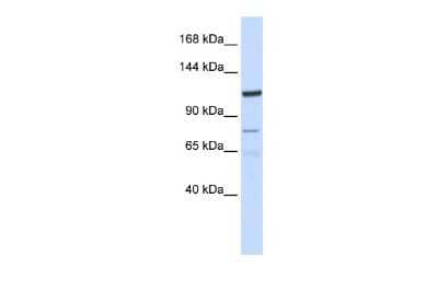 Western Blot: EIG121 Antibody [NBP2-84846] - WB Suggested Anti-KIAA1324 Antibody Titration: 0.2-1 ug/ml. ELISA Titer: 1:312500. Positive Control: Hela cell lysate