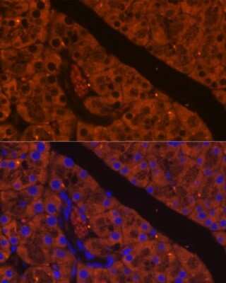 Immunohistochemistry ELA2A Antibody - Azide and BSA Free