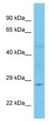 Western Blot: ELA2A Antibody [NBP3-10646] - Western blot analysis of ELA2A in Large intestine Tumor lysates. Antibody dilution at 1.0ug/ml