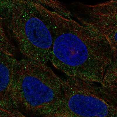 Immunocytochemistry/Immunofluorescence: ELA3A Antibody [NBP2-58716] - Staining of human cell line U-2 OS shows localization to cytosol.