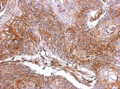 Immunohistochemistry-Paraffin: ELA3A Antibody [NBP2-14946] - Paraffin-embedded Cal27 xenograft, using antibody at 1:500 dilution.