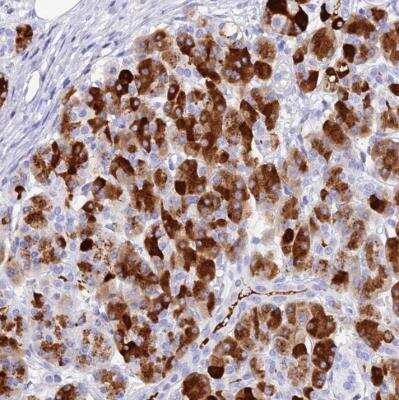 Immunohistochemistry-Paraffin: ELA3A Antibody [NBP2-54725] - Staining of human pancreas shows strong cytoplasmic positivity in exocrine glandular cells.