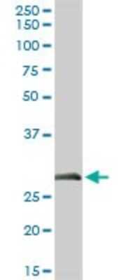 Western Blot: ELA3A Antibody [H00010136-D01P] - Analysis of ELA3A expression in human pancreas.