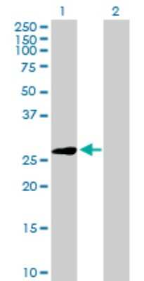 Western Blot: ELA3A Antibody [H00010136-D01P] - Analysis of ELA3A expression in transfected 293T cell line by ELA3A polyclonal antibody.Lane 1: ELA3A transfected lysate(29.50 KDa).Lane 2: Non-transfected lysate.