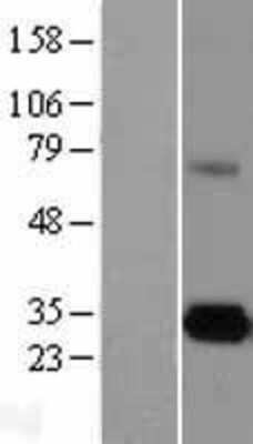 Western Blot: ELA3A Overexpression Lysate (Adult Normal) [NBL1-10220] Left-Empty vector transfected control cell lysate (HEK293 cell lysate); Right -Over-expression Lysate for ELA3A.