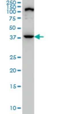 Western Blot: ELAC1 Antibody (1G2) [H00055520-M01] - ELAC1 monoclonal antibody (M01), clone 1G2 Analysis of ELAC1 expression in PC-12.