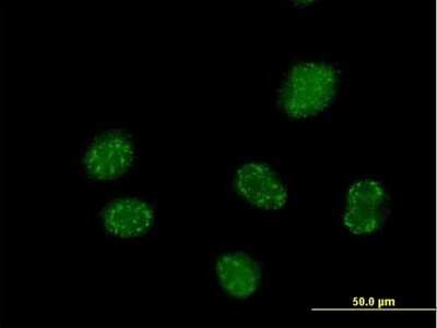 Immunocytochemistry/Immunofluorescence: ELAC1 Antibody [H00055520-B01P] - Analysis of purified antibody to ELAC1 on HeLa cell. (antibody concentration 10 ug/ml)
