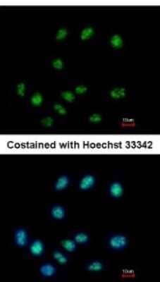 Immunocytochemistry/Immunofluorescence: ELAC1 Antibody [NBP2-16313] - Analysis of paraformaldehyde-fixed A549, using antibody at 1:500 dilution.