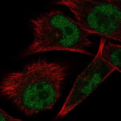 Immunocytochemistry/Immunofluorescence: ELAC1 Antibody [NBP2-57039] - Staining of human cell line SK-MEL-30 shows localization to nucleoplasm.