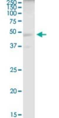 Western Blot: ELAC1 Antibody [H00055520-B01P] - Analysis of ELAC1 expression in 293.
