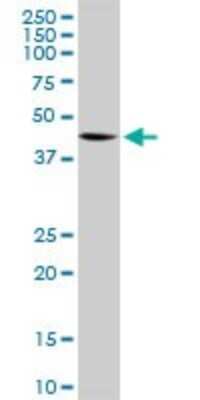 Western Blot: ELAC1 Antibody [H00055520-D01P] - Analysis of ELAC1 expression in Jurkat.