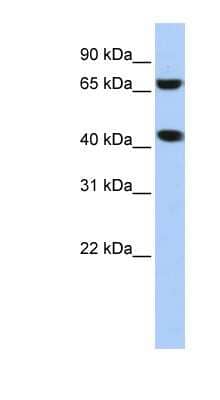 Western Blot: ELAC1 Antibody [NBP1-55326] - Titration: 0.2-1 ug/ml, Positive Control: HepG2 cell lysate.