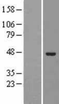 Western Blot: ELAC1 Overexpression Lysate (Adult Normal) [NBL1-10222] Left-Empty vector transfected control cell lysate (HEK293 cell lysate); Right -Over-expression Lysate for ELAC1.