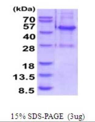 SDS-Page: ELAC1 Recombinant Protein [NBP2-52119] - 15% SDS Page (3 ug)