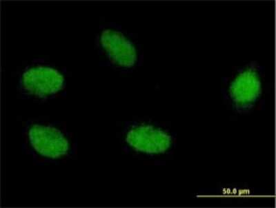 Immunocytochemistry/Immunofluorescence: ELAC2 Antibody (1A2) [H00060528-M01] - Analysis of monoclonal antibody to ELAC2 on HeLa cell . Antibody concentration 10 ug/ml.