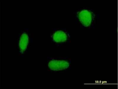 Immunocytochemistry/Immunofluorescence: ELAC2 Antibody [H00060528-B01P] - Analysis of purified antibody to ELAC2 on HepG2 cell. (antibody concentration 10 ug/ml)