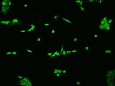 Immunocytochemistry/Immunofluorescence: ELAC2 Antibody [NBP2-97772] - Immunofluorescence staining of ELAC2 in A431 cells. Cells were fixed with 4% PFA, permeabilzed with 0.1% Triton X-100 in PBS, blocked with 10% serum, and incubated with rabbit anti-Human ELAC2 polyclonal antibody (dilution ratio 1:200) at 4C overnight. Then cells were stained with the Alexa Fluor(R)488-conjugated Goat Anti-rabbit IgG secondary antibody (green). Positive staining was localized to Nucleus.