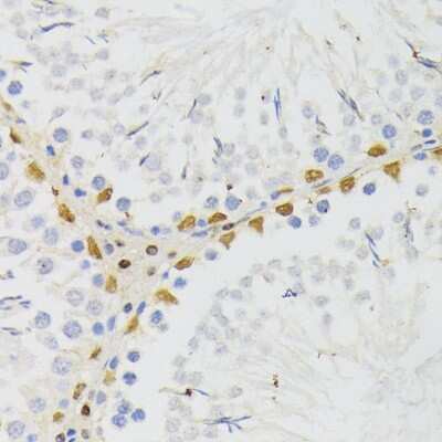 Immunohistochemistry-Paraffin: ELAC2 Antibody [NBP3-04612] - Paraffin-embedded rat testis using ELAC2 antibody at dilution of 1:200 (40x lens).