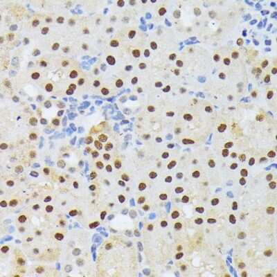 Immunohistochemistry-Paraffin: ELAC2 Antibody [NBP3-04612] - Paraffin-embedded mouse kidney using ELAC2 antibody at dilution of 1:200 (40x lens).