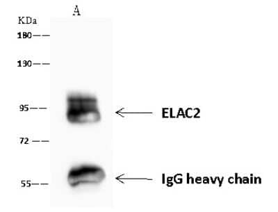 Immunoprecipitation: ELAC2 Antibody [NBP2-97772] - ELAC2 was immunoprecipitated using: Lane A: 0.5 mg Jurkat Whole Cell Lysate 4 ul anti-ELAC2 rabbit polyclonal antibody and 60 ug of Immunomagnetic beads Protein A/G.  Primary antibody: Anti-ELAC2 rabbit polyclonal antibody, at 1:100 dilution. Secondary antibody: Goat Anti-Rabbit IgG (H+L)/HRP at 1/10000 dilution. Developed using the ECL technique. Performed under reducing conditions. Predicted band size: 92 kDa. Observed band size: 95 kDa