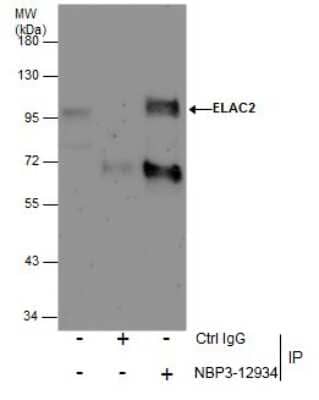 Immunoprecipitation: ELAC2 Antibody [NBP3-12934] - Immunoprecipitation of ELAC2 protein from Jurkat whole cell extracts using 5 ug of ELAC2 antibody (NBP3-12934). Western blot analysis was performed using ELAC2 antibody (NBP3-12934). EasyBlot anti-Rabbit IgG was used as a secondary reagent.