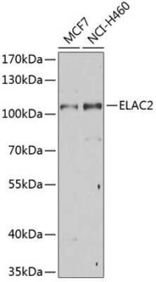 Western Blot: ELAC2 Antibody [NBP3-04612] - Analysis of extracts of various cell lines, using ELAC2 antibody at 1:1000 dilution. Secondary antibody: HRP Goat Anti-Rabbit IgG (H+L) at 1:10000 dilution. Lysates/proteins: 25ug per lane. Blocking buffer: 3% nonfat dry milk in TBST. Detection: ECL Basic Kit