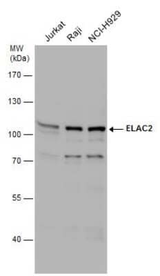 Western Blot: ELAC2 Antibody [NBP3-12934] - Various whole cell extracts (30 ug) were separated by 7.5% SDS-PAGE, and the membrane was blotted with ELAC2 antibody (NBP3-12934) diluted at 1:1000.