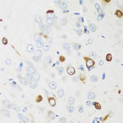 Immunohistochemistry-Paraffin: ELAVL2 Antibody [NBP3-03894] - Paraffin-embedded rat brain using ELAVL2 antibody at dilution of 1:200 (40x lens).