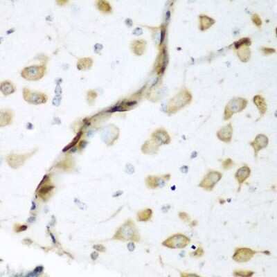 Immunohistochemistry-Paraffin: ELAVL2 Antibody [NBP3-03894] - Paraffin-embedded mouse brain using ELAVL2 antibody at dilution of 1:200 (40x lens).