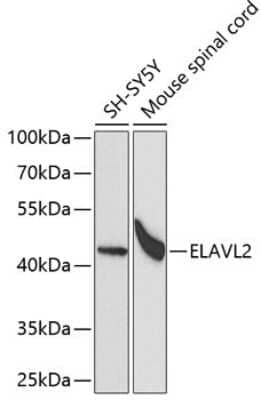 Western Blot: ELAVL2 Antibody [NBP3-03894] - Analysis of extracts of various cell lines, using ELAVL2 antibody at 1:1000 dilution. Secondary antibody: HRP Goat Anti-Rabbit IgG (H+L) at 1:10000 dilution. Lysates/proteins: 25ug per lane. Blocking buffer: 3% nonfat dry milk in TBST. Detection: ECL Basic Kit.