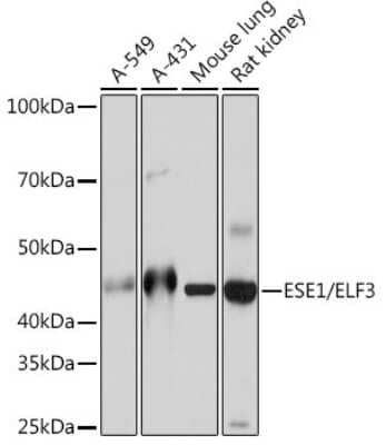 Western Blot: ELF3/ESE-1 Antibody (7O2V4) [NBP3-16429] - Western blot analysis of extracts of various cell lines, using ELF3/ESE-1 Rabbit mAb (NBP3-16429) at 1:1000 dilution. Secondary antibody: HRP Goat Anti-Rabbit IgG (H+L) at 1:10000 dilution. Lysates/proteins: 25ug per lane. Blocking buffer: 3% nonfat dry milk in TBST. Detection: ECL Basic Kit. Exposure time: 10s.